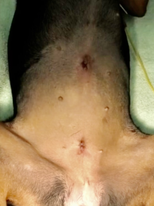 腹腔鏡③　避妊（不妊）手術について